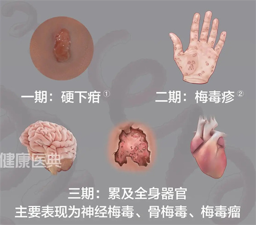 图片细节